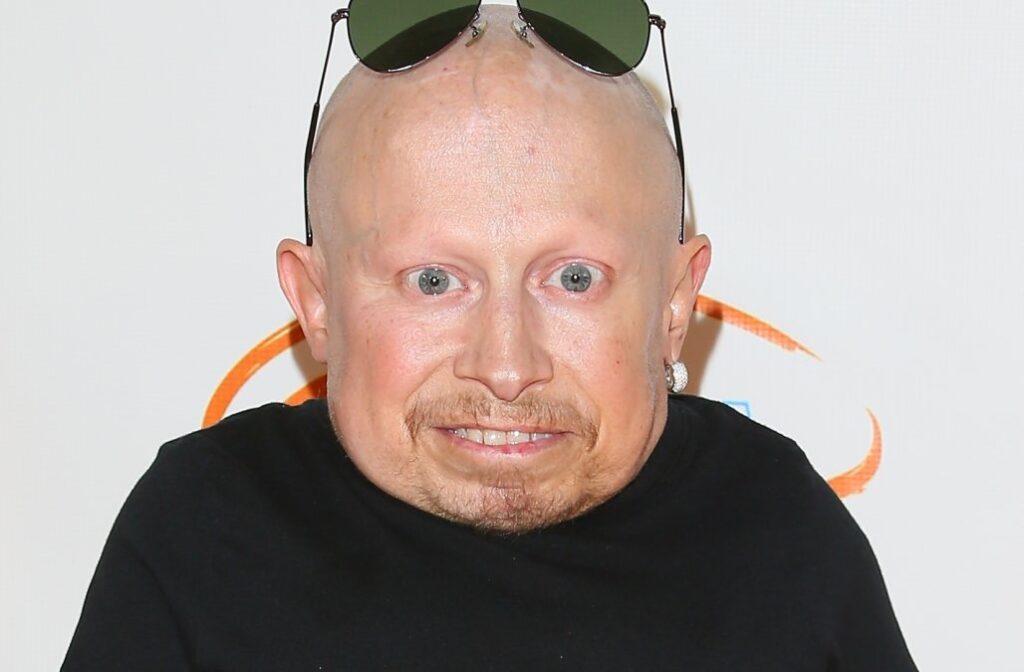 Verne Troyer's Death Cause Ruled as Suicide 1 puza
