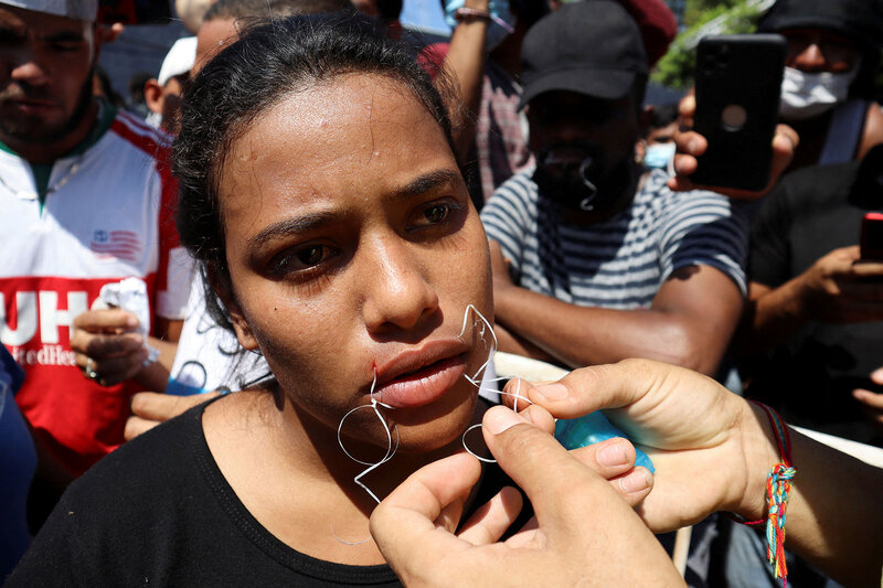 Migrants sew mouths shut at border protest in Mexico