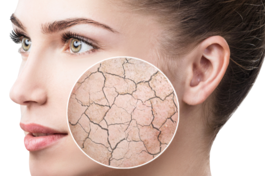7 Dermatologist Approved Tips To Get Clear Skin